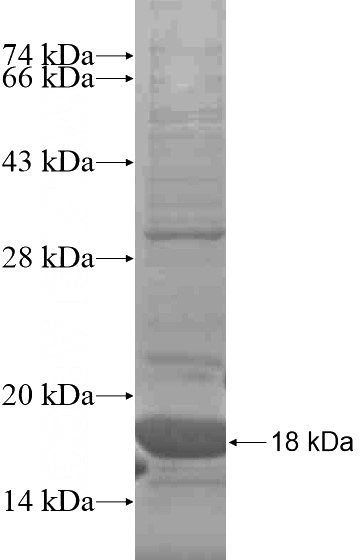 Recombinant Human CEBPD SDS-PAGE
