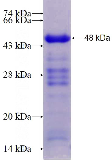 Recombinant Human IDH3B SDS-PAGE