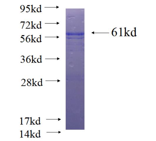Recombinant human GP1BA SDS-PAGE