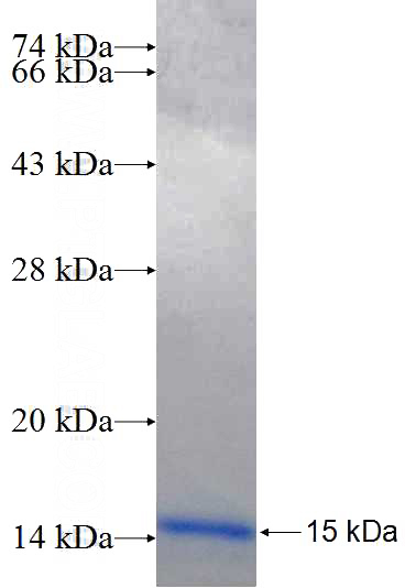 Recombinant Human SH3GL1 SDS-PAGE