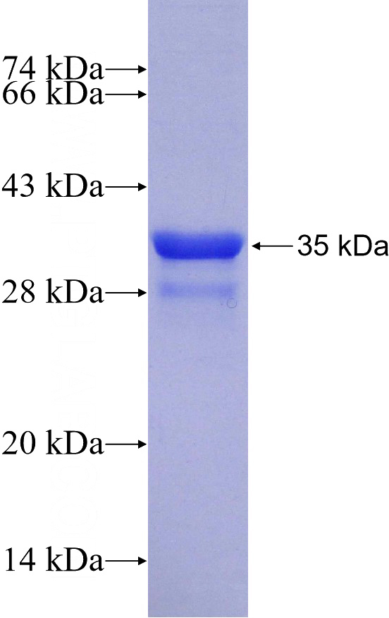 Recombinant Human Integrin beta-5 SDS-PAGE