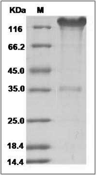 Mouse SELP / selectin P / P-selectin Protein (Fc Tag) SDS-PAGE