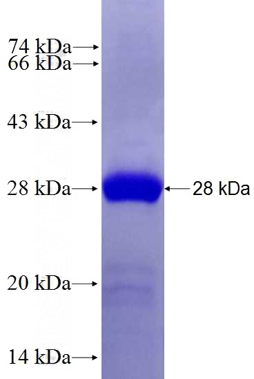 Recombinant Human TRAPPC4 SDS-PAGE