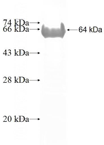 Recombinant Human ETV1 SDS-PAGE