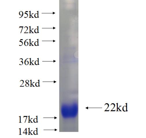 Recombinant Arabidopsis thaliana Pgb1 SDS-PAGE