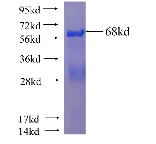 Recombinant human LIAS SDS-PAGE
