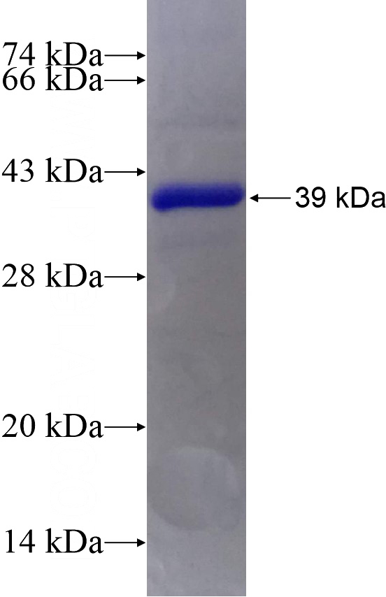 Recombinant Human RIMS3 SDS-PAGE