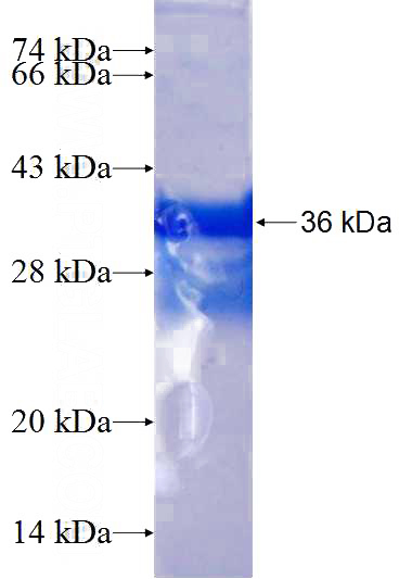 Recombinant Human HMGN4 SDS-PAGE