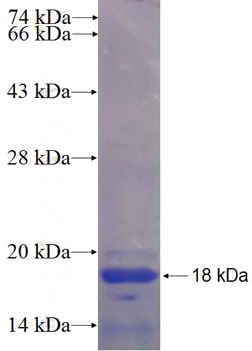 Recombinant Human CNN2 SDS-PAGE