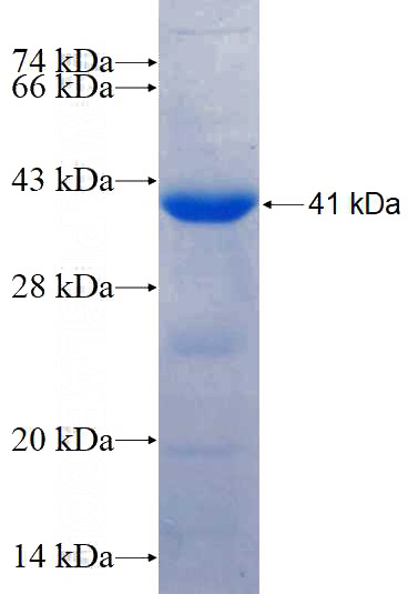 Recombinant Human SELENBP1 SDS-PAGE