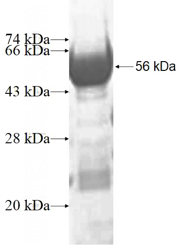Recombinant Human PSMA1 SDS-PAGE