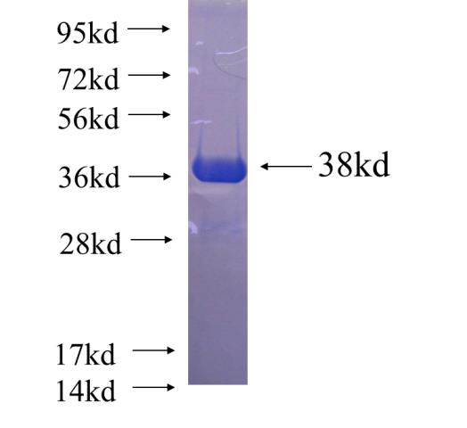 Recombinant human HOXA10 SDS-PAGE