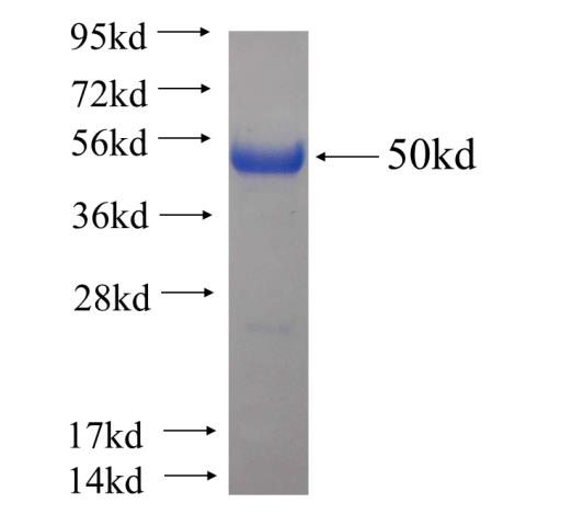Recombinant human TRA-1-60 SDS-PAGE