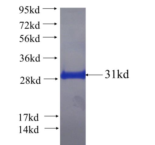 Recombinant human RMND5B SDS-PAGE