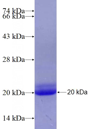 Recombinant Human TP53BP1 SDS-PAGE