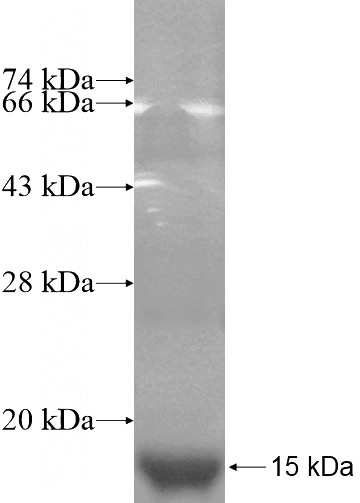 Recombinant Human NDUFB2 SDS-PAGE