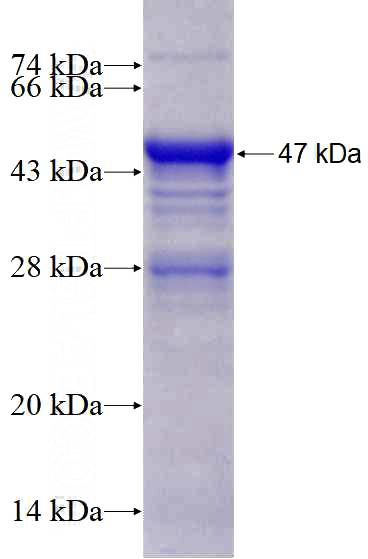 Recombinant Human UBN1 SDS-PAGE