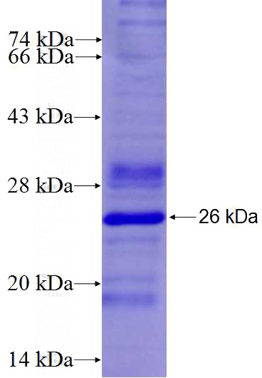 Recombinant Human C14orf21 SDS-PAGE