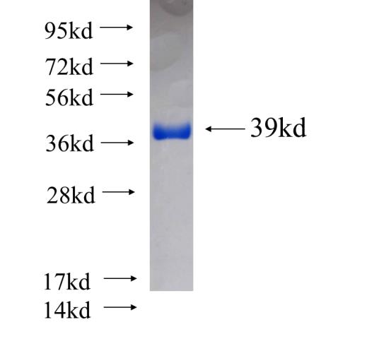 Recombinant human LACTB SDS-PAGE