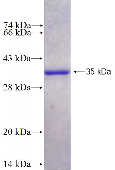 Recombinant Human CAMK2N2 SDS-PAGE