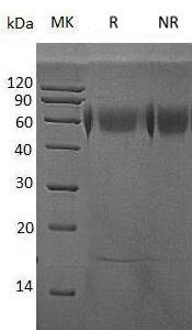 Human MICA/PERB11.1 (His tag) recombinant protein
