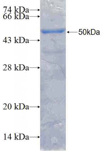 Recombinant Human NLRP10 SDS-PAGE