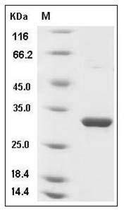 Human LMAN2 / VIP36 Protein (His Tag) SDS-PAGE