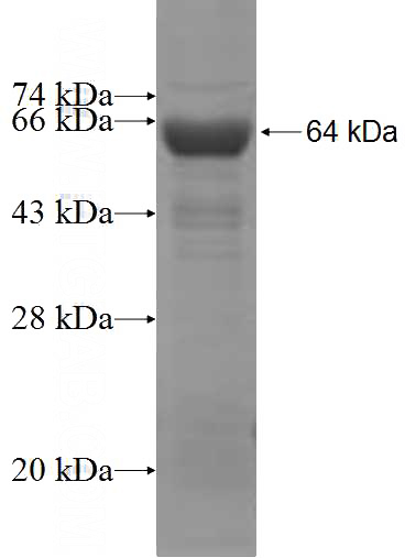 Recombinant Human COPB2 SDS-PAGE