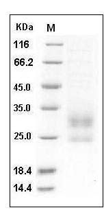 Mouse LY86 / MD-1 Protein (His Tag) SDS-PAGE
