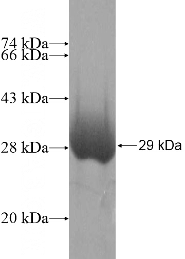 Recombinant Human CLCN7 SDS-PAGE