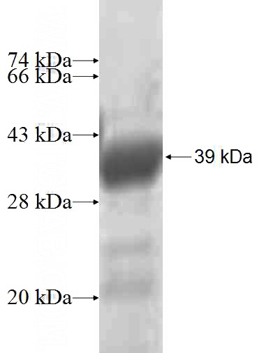 Recombinant Human MYO1D SDS-PAGE