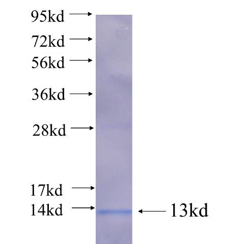 Recombinant human IMPDH1 SDS-PAGE