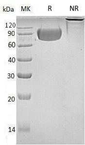 Human CD33/SIGLEC3 (Fc & His tag) recombinant protein