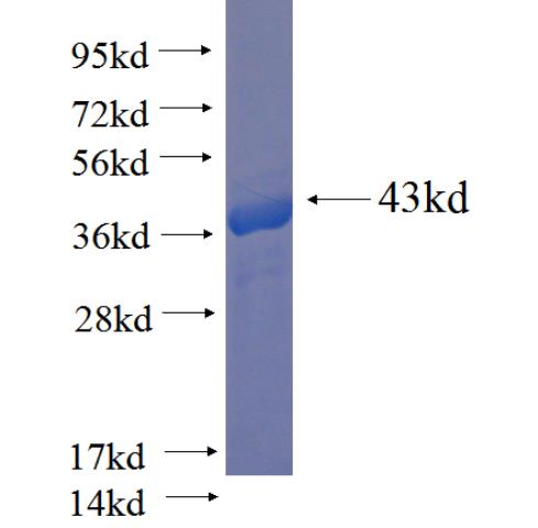 Recombinant human EIF5B SDS-PAGE