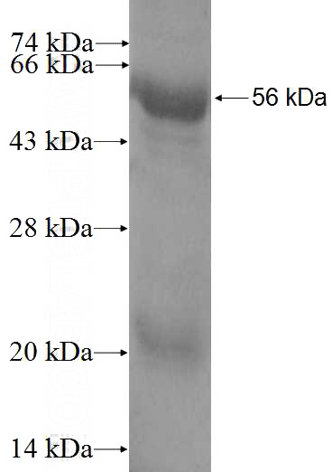 Recombinant Human KIF2C SDS-PAGE