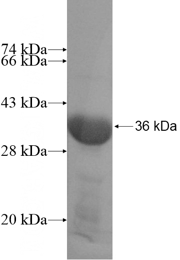 Recombinant Human DNASE1L2 SDS-PAGE