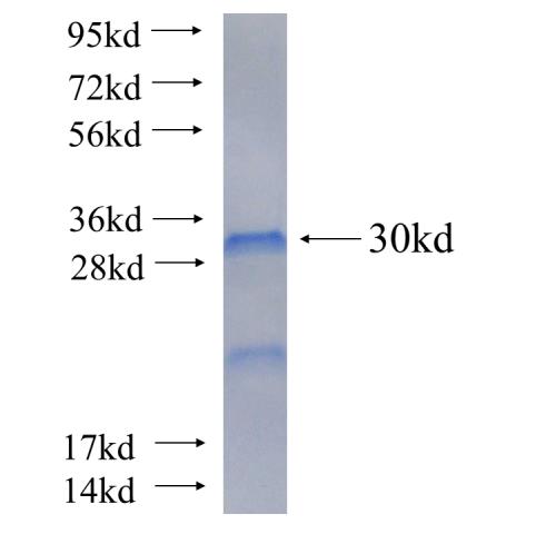 Recombinant human PEX16 SDS-PAGE