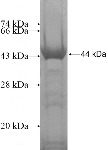 Recombinant Human ZNF627 SDS-PAGE