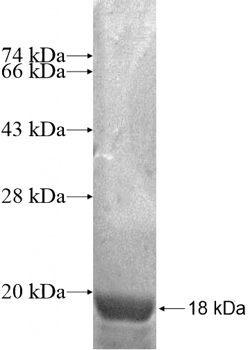 Recombinant Human NAP1L2 SDS-PAGE