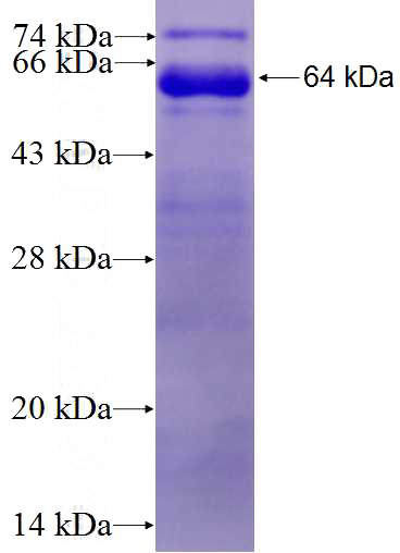 Recombinant Human PHC1 SDS-PAGE