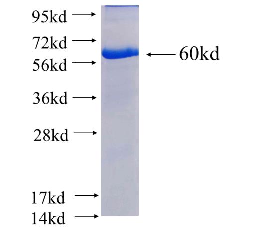 Recombinant human NAPB SDS-PAGE