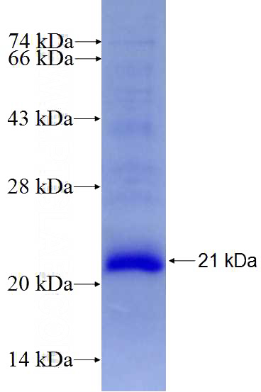 Recombinant Human RNF186 SDS-PAGE
