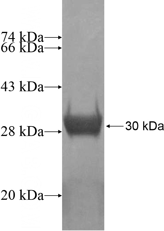 Recombinant Human USP47 SDS-PAGE