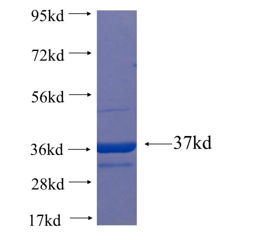 Recombinant Arabidopsis thaliana ERS1 SDS-PAGE