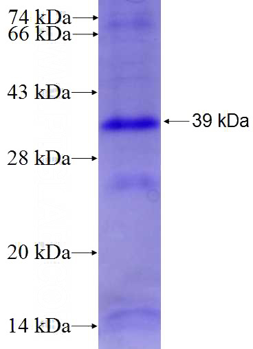 Recombinant Human PIWIL2 SDS-PAGE