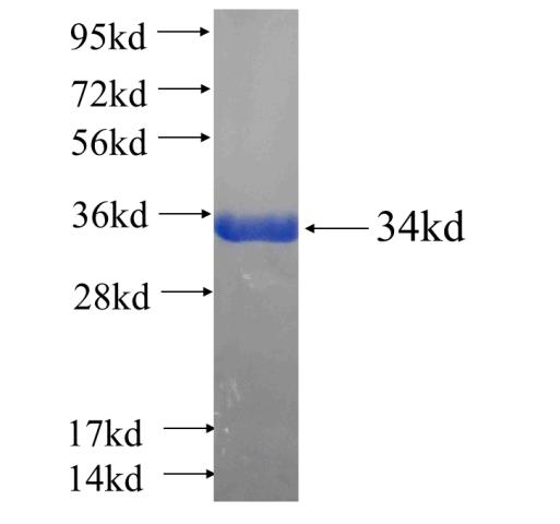 Recombinant human SSPN SDS-PAGE