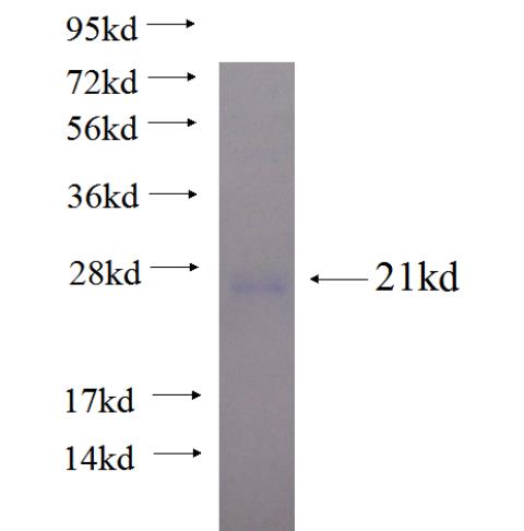 Recombinant human C2orf3 SDS-PAGE
