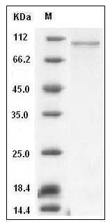 Mouse AGO2 / Argonaute 2 / EIF2C2 Protein (His Tag) SDS-PAGE