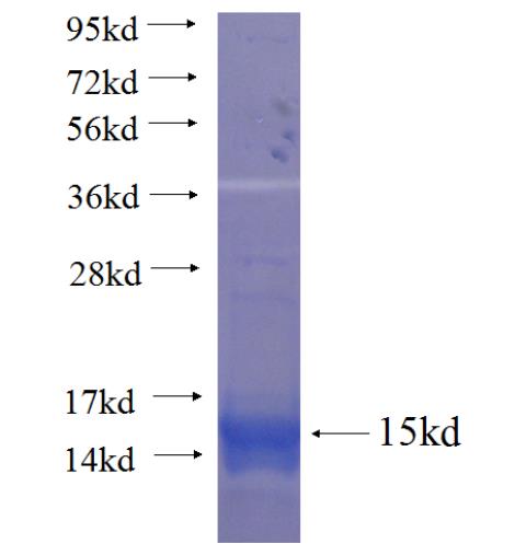 Recombinant human SLC5A6 SDS-PAGE