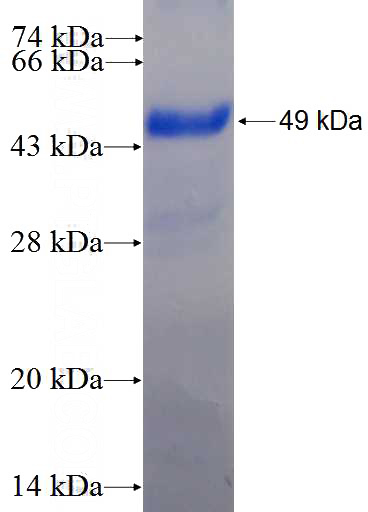 Recombinant Human UCK1 SDS-PAGE